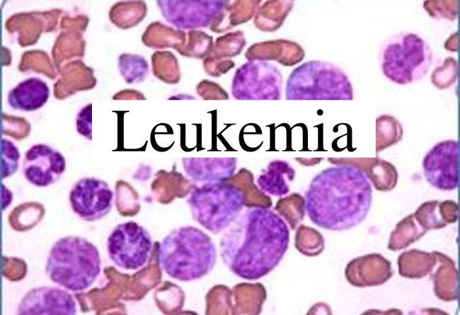 Stem-Cell-Leukemia-Cell-Link-Exposed-650x487